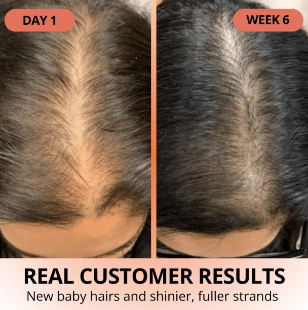 SOVARA™ PUMPKIN SEED OIL+SAW PALMETTO