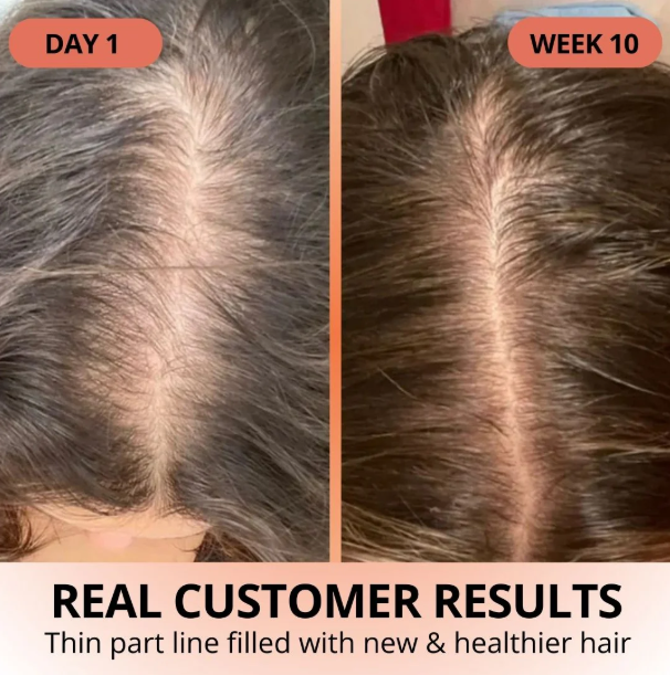 SOVARA™ PUMPKIN SEED OIL+SAW PALMETTO