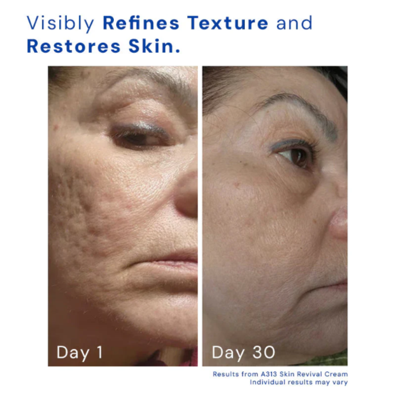 SOVARA - RETINOL SKIN REVIVAL CREAM™