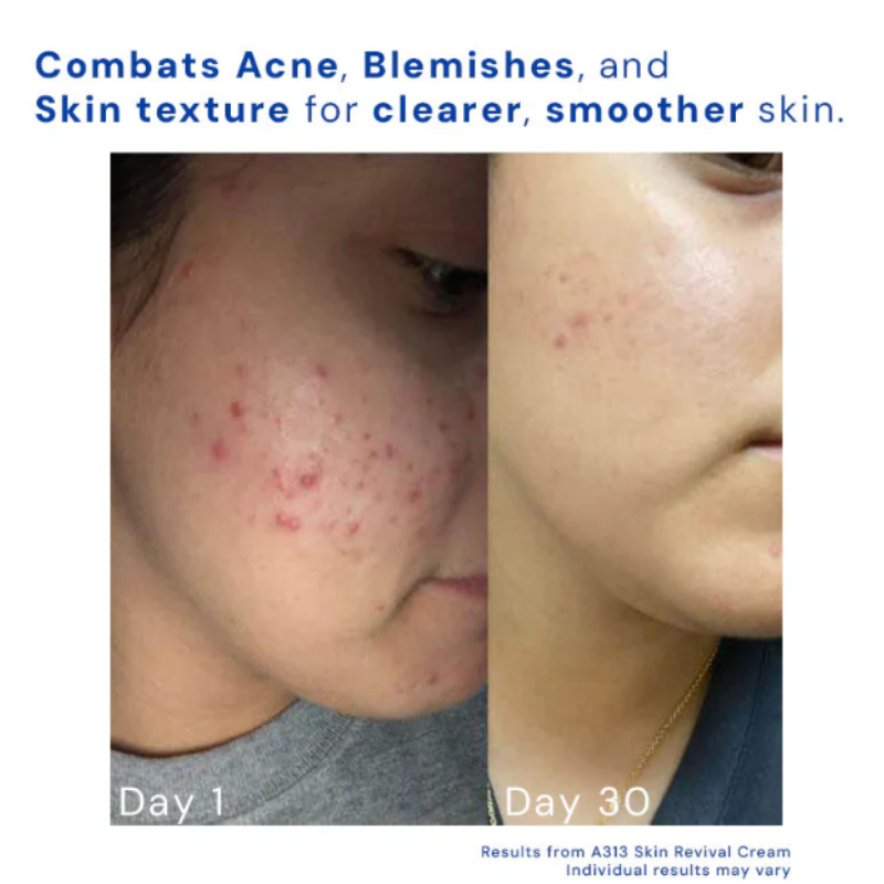 SOVARA - RETINOL SKIN REVIVAL CREAM™
