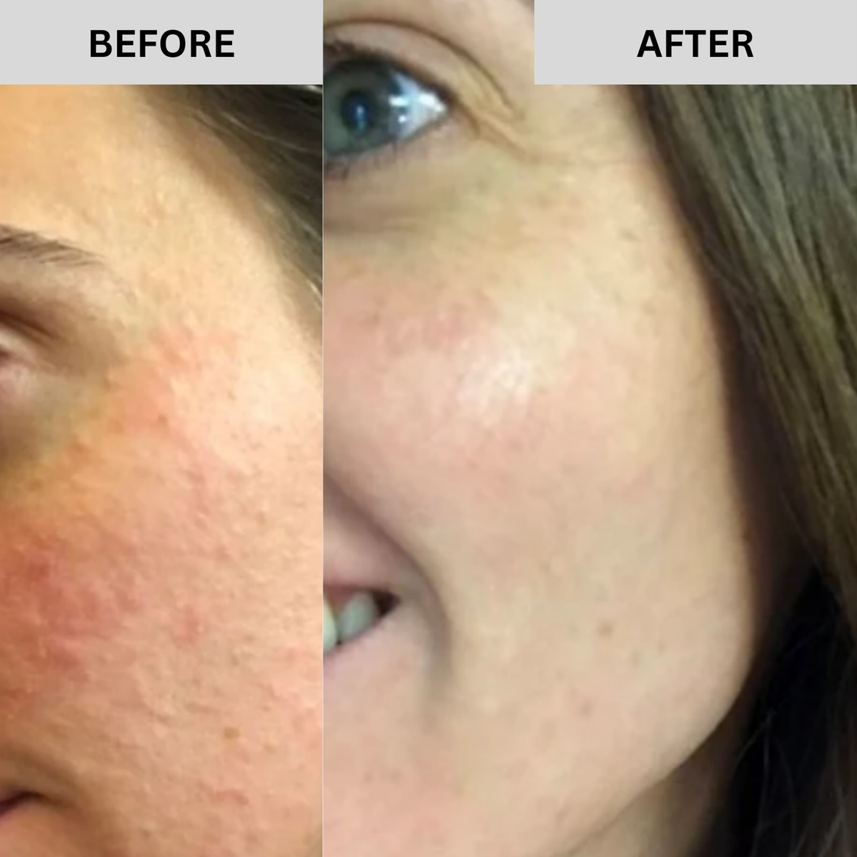 SOVARA® RINDFETT & HONIG BALSAM