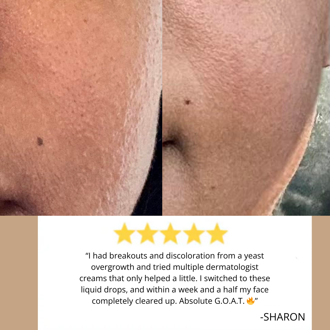 SOVARA™ BLACK WALNUT WORMWOOD PARASITE CLEANSE