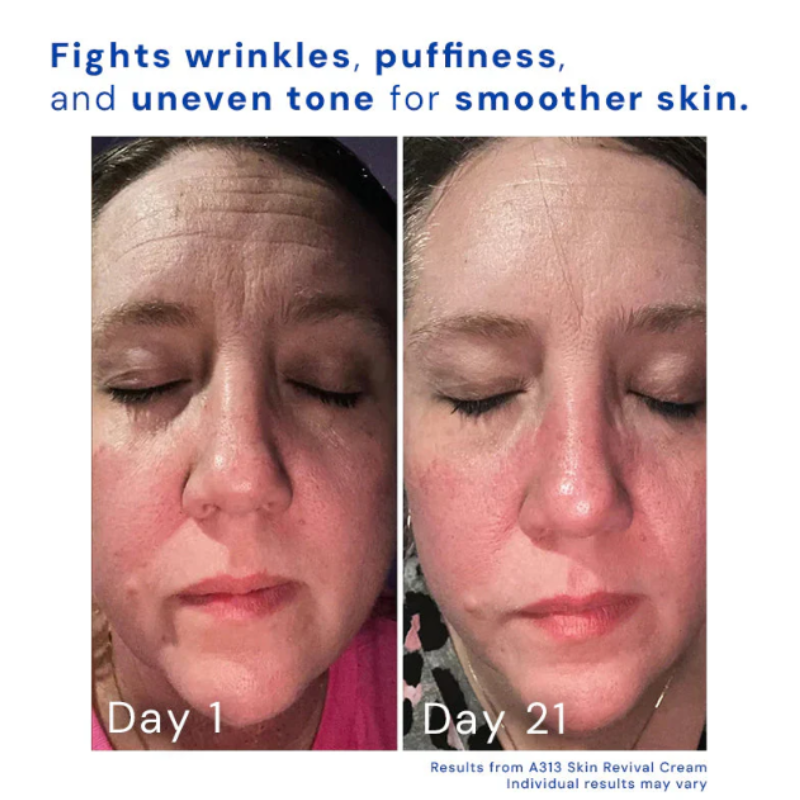 SOVARA - RETINOL SKIN REVIVAL CREAM™